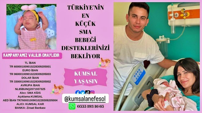 2 aylık Kumsal'ın 4 ayı kaldı