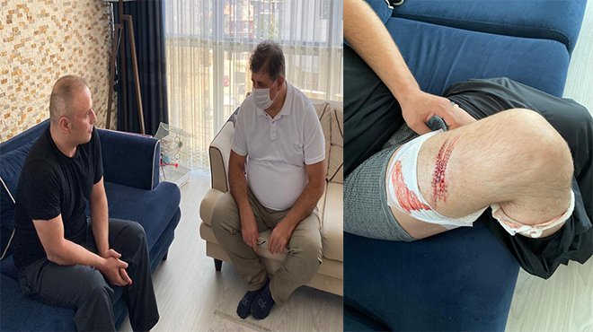 Belediye çadırlarına çirkin saldırı