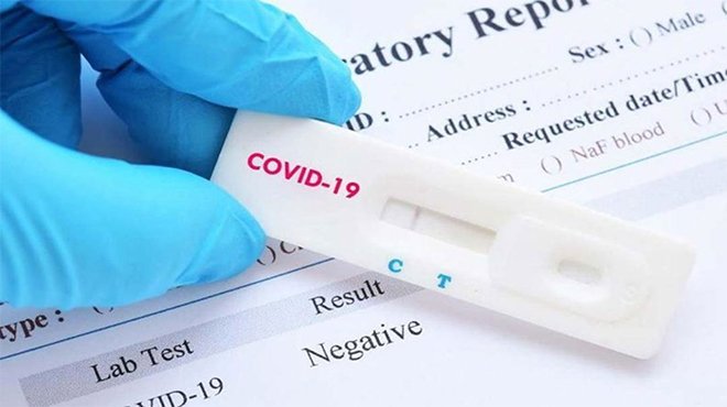 COVID 19’a yine Türk imzası