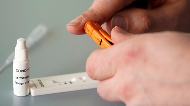EBSO’dan firmalara Covid-19 antikor testi