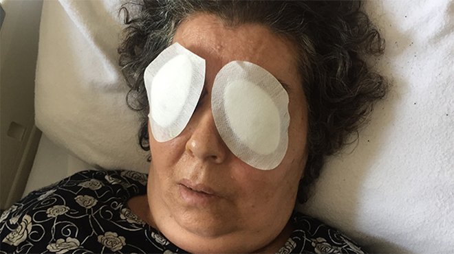 Hastanede göz çıkarma olayında başhekim açığa alındı
