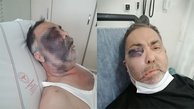 Komşularından dayak yiyen yüzde 90 engelli şahıs, öldü